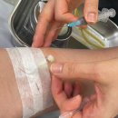 라파온누리약국 | 수원 영통 대장·항문과 차외과 의원 위·대장내시경 후기 | 국가검진 내시경 비용·준비방법 총정리