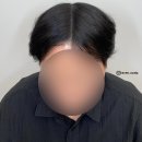레이븐스칼프