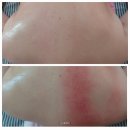 오산 궐동 바디관리 오즈마사지에서 에너지테라피 통증관리 후기