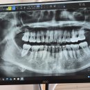 서울럭스치과의원 이미지