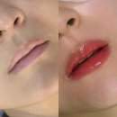 미치게 - 서구 상무민주로 80 | 강동구 천호동 입술문신 발색 진짜 미치게 잘나온 리메이드 강동점 후기
