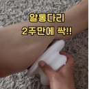 더 뉴 알통짐 | 2주 만에 알통다리 라인 달라짐, 뉴스킨 웰스파 효과 진짜 있네요
