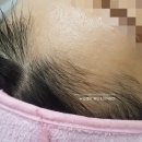 가람헤어라인