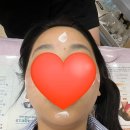 실펌 엑스 후기 강남 강남 뉴케이의원 후기 실펌X 효과