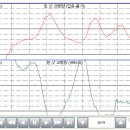 좌동카센타 이미지
