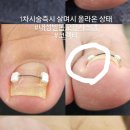 아모먼트