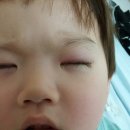 튼튼소아과 네이버블로그