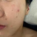 비움채뷰티아비스 이미지