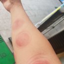 경희일생한의원 | 동대문구 장안동 경희일생한의원(후기글2)