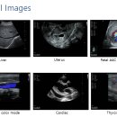 엔도소노 이미지