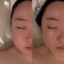 [포천 피부관리] 피부/얼굴라인 맛집 &#39;오늘도 맑음&#39; 라인관리 받은 후기!!
