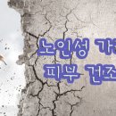 노인성 가려움증, 이미지