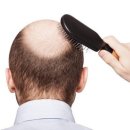 우후죽순식품 (유) | 선선한 가을바람과 함께 찾아온 탈모…가을엔 왜 머리카락 잘 빠지나?