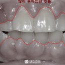 서울에스(S)퍼스트치과의원 이미지