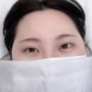 넌눈이예뻐 이미지