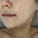 용인 속눈썹펌 전문 나리뷰티에서 피부 윤곽관리 받은 후기
