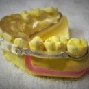 저스트치과기공소 이미지