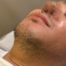 아카시아 약국 | 불혹 남편의 변화 수원턱수염왁싱 다녀온 후기