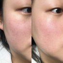 프롬자스민 | 프롬나인 플리오르 카밍 선 세럼과 크림으로 광명 찾은 내 돈 내산 솔직 후기