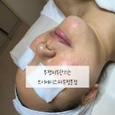 주식회사 바디채널 부평점 | 부평피부관리는 브이메디스파부평본점