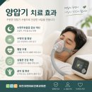연예인도 쓰는 양압기? 수면무호흡증 치료는 이제 건강관리입니다