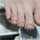 네일은빛나 이미지