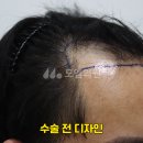 모엠의원 이미지