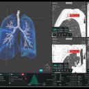 코어소프트 이미지