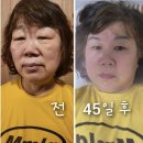 전도를 위한 산화질소 사우나 운영 이미지