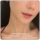 서울최마취통증의학과의원 | 울쎄라 300샷 가격 정도의 효과 있을까? 서울 압구정 피부과 시술 전 꼭 체크할 통증 후기