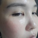 이디메디칼 | 잡티에 최고 화이트닝 셀투덤 멀티 발란스 부스터 앰플