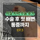(주)푸른샘 | 치질 치핵 수술 후기 3, 1일차 2일차 화장실과 통증 그리고 좌욕