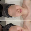 금암1동-15(대남한의원) | 마산피부관리 웨딩관리 잘 하는 에스테틱 추천! 미엘르지스킨