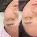 라라뷰티살롱 | [김해/장유] 김해장유피부관리 장유율하피부관리 에그뷰티 라라필관리 후기