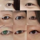 계속 붓는 눈으로 방문한 병원 간단 후기 | 소망내과 | 서울드림이비인후과