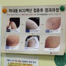 가평군보건소 | 가평보건소 BCG 피내용 접종후기&amp;예약 방법