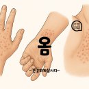 옴