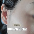 서구-2 | 인천 서구 피부관리 비비드엘 2회차 후기 임신 출산 후 진해진 기미와 잡티 드디어 작별 중