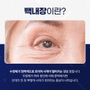 예스안과 이미지
