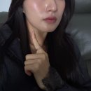 사당역 | 사당역 피부과 온다리프팅 후기 4만줄 효과