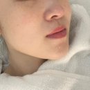 올바른영양 | 탄력,보습 관리 올바른뷰티 고양삼송점 스킨젝션 관리 후기