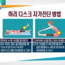 허리디스크 증세 통증 완화 운동 허리디스크 자가진단 이미지