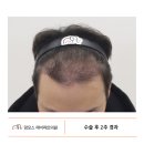 압구정동헤어라인