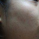 (주)이엔비 | 아줄렌수더겔 민감한피부 수분공급 필수 템
