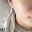 빛온 | 어나더페이스 나이아치온 빛 세럼, 겔 마스크 기초 케어 후기