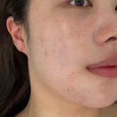 경기도 수원시 팔달구 중부대로106번길 29 (인계동) | 수원 인계동 피부관리 추천 &lt;더라르떼&gt; 플라즈마·LDM·데콜테로 예민한 피부 관리 후기