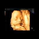 효성평생건강센터 | 효성병원 입체(4D)초음파 후기