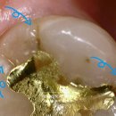 부마치과 이미지