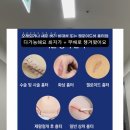 집중짱바둑교실(B) | 짱짱맘과 함께하는 제왕절개 흉터 완벽가이드!