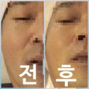 아산피부관리 잘하는 곳 추천, 용화동 브니엘에스테틱 비타민DX테라피 후기